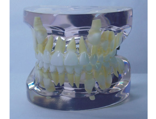 透明乳牙发育模型（9~12岁）